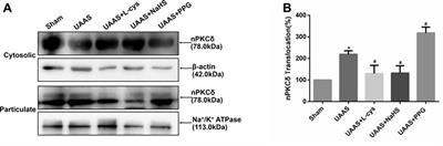 Hydrogen Sulfide Protects Against Uremic Accelerated Atherosclerosis via nPKCδ/Akt Signal Pathway